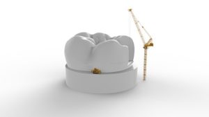 Zahnbaustelle Dentaltechnik